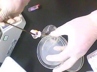 環(huán)氧乙烷滅菌殘留量